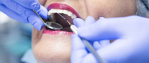 Best Emergency Dentist for Knocked-Out Tooth in White River Junction, VT